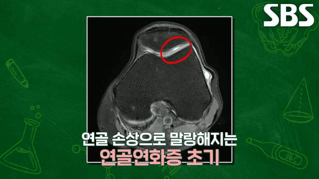 좋은아침