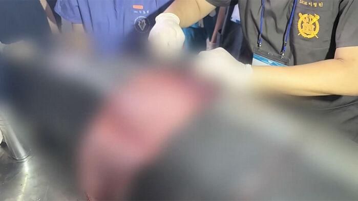 몸속 수백개 우글우글…"뚫리고 부풀어" 고통 속 질식사