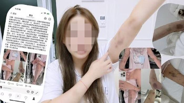 "하룻밤 보내자" 거절하자 퍽퍽…홍대 공포의 남성 정체