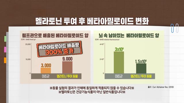  치매 원인 뇌 독성 물질 베타아밀로이드