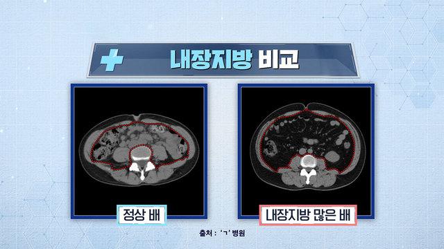 이경규의 경이로운 습관