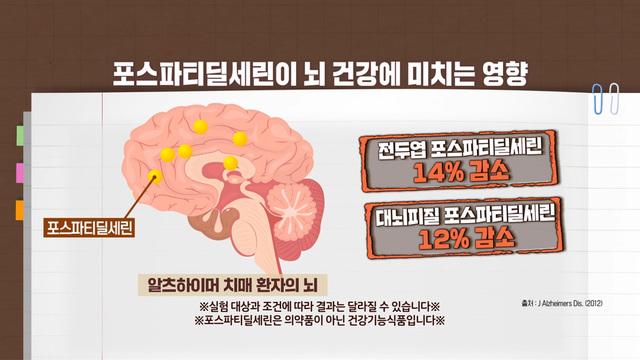 치매 유발 핵심, 포스파티딜세린 감소
