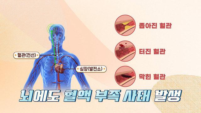 치매 발병 위험을 높이는 콜레스테롤