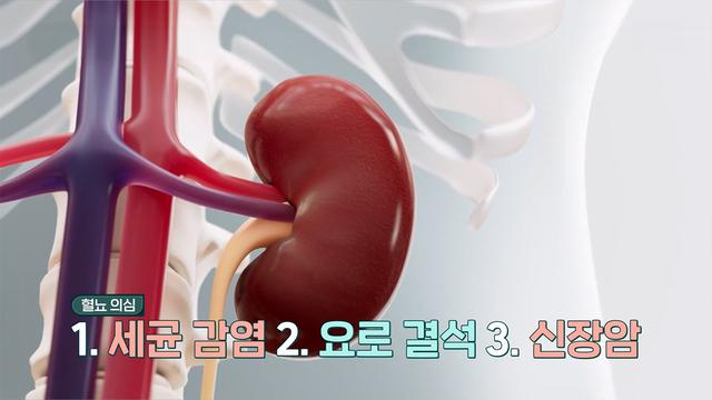 좋은아침