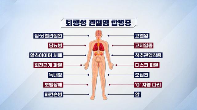 시크릿 코드