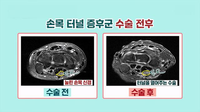 좋은아침