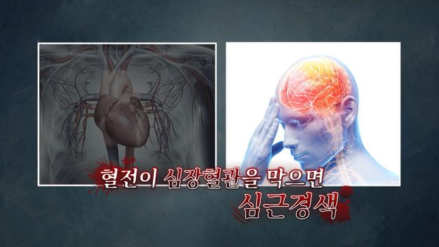 시크릿 코드