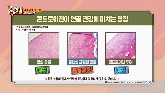 오늘부터 인생 2막