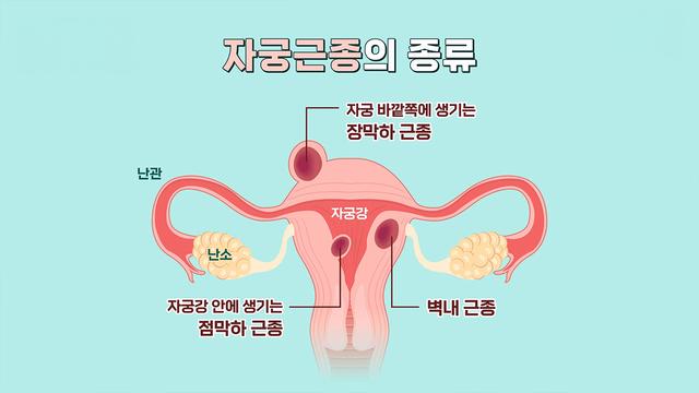 좋은아침