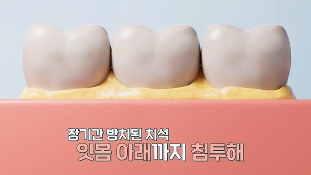 좋은아침