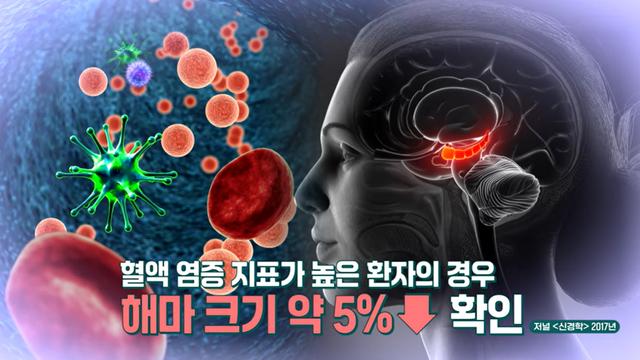 좋은아침