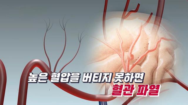 히든카드