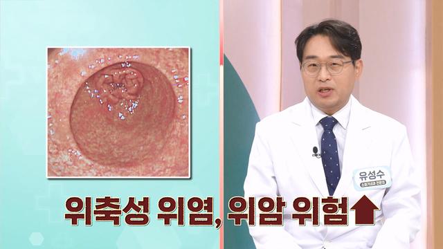 위기의 위(胃)를 구하라!