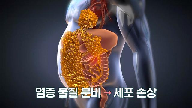 장이 건강해야 전신이 건강하다!